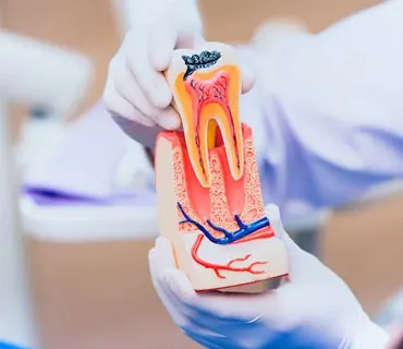 root-canel-treatment